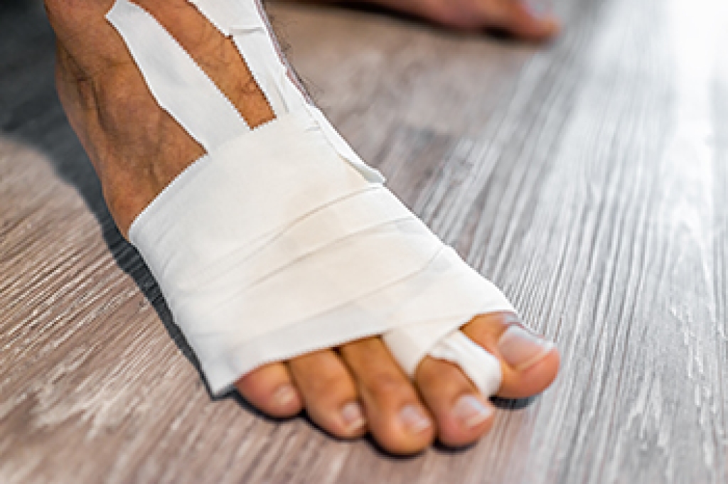 Sprained Toe Injuries Can Make Every Step Painful